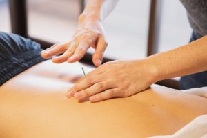 Acupuncture: All Benefits and Harms.What Do You Need To Know?